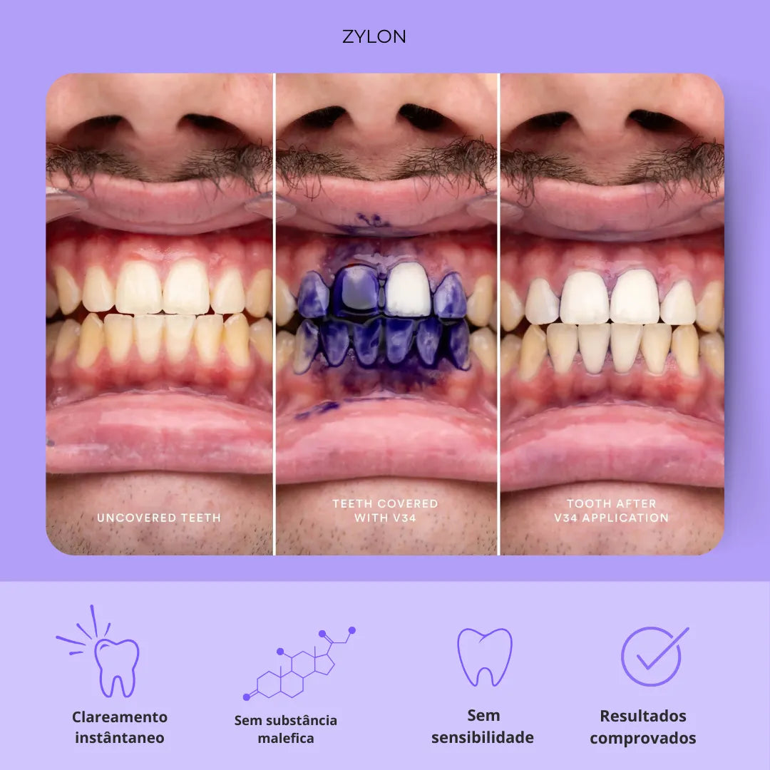 Vita V34™ | Clareador dental instantâneo | Dentes + brancos na primeira aplicação